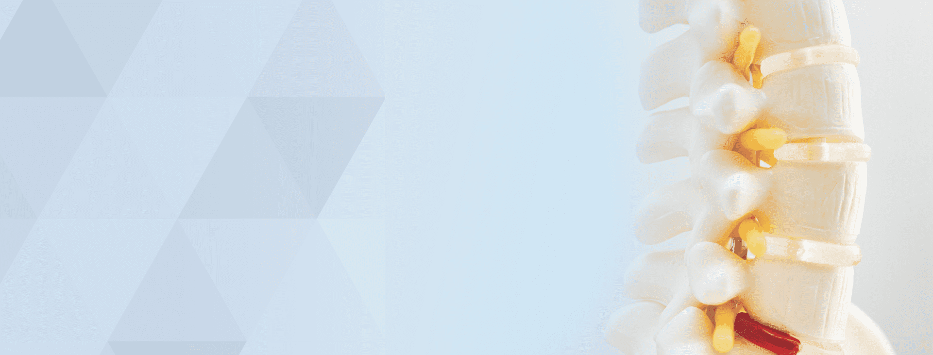 Lumbar Facet Syndrome