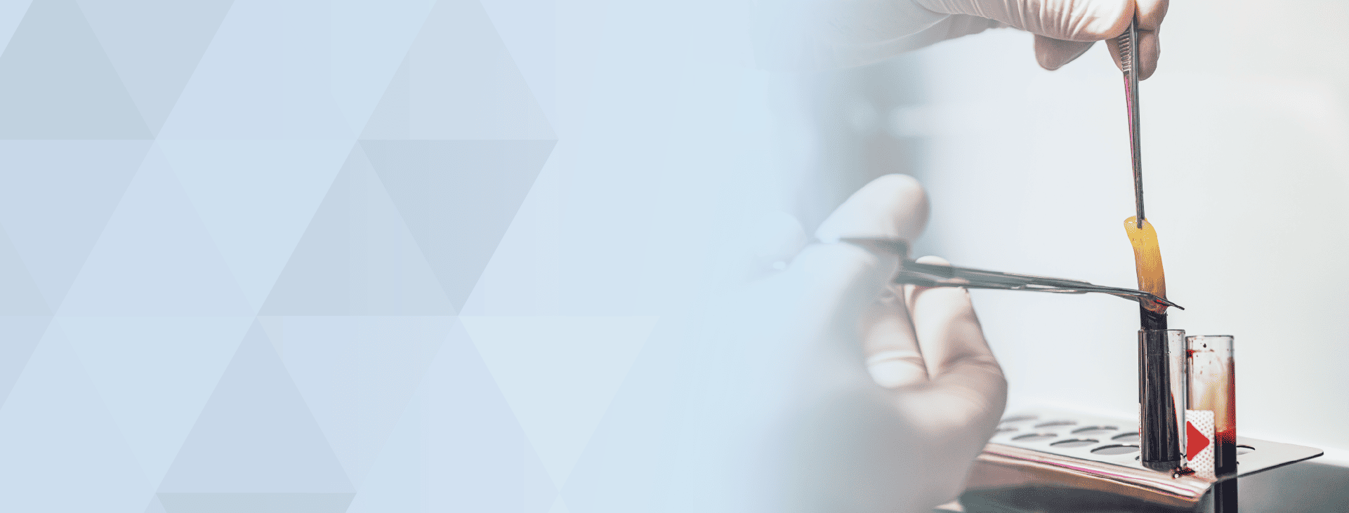 Meet Platelet Rich Fibrin